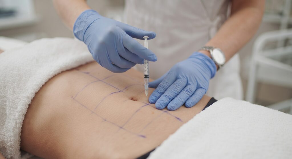 Mesoterapia corporal en El Albir