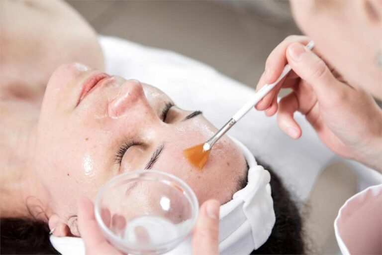 Medical chemical peel in El Albir