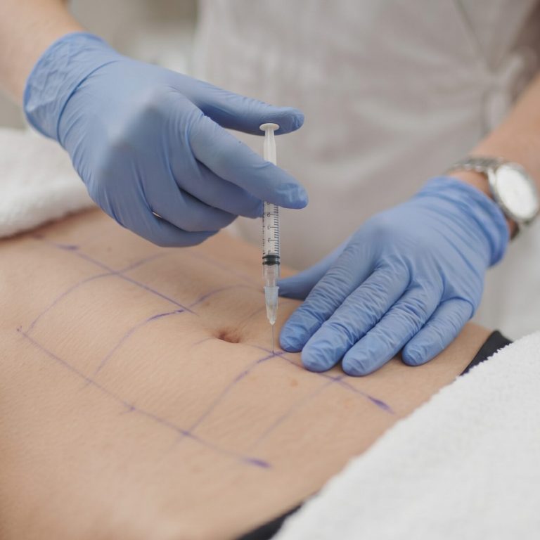 Mesoterapia corporal en El Albir: infiltración en abdomen en Alta Armonía